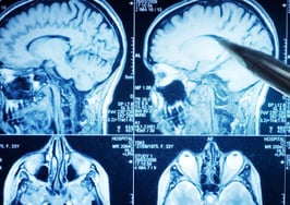 How to market to the reptilian brain