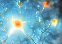 Neural network
