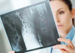 A female doctor examining an X-Ray