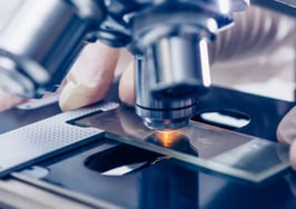 A close-up of a man's hand with a microscope
