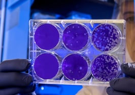 Would you live in a house made from living bacteria?